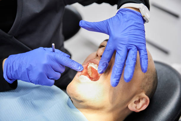 Best Knocked-Out Tooth (Avulsed Tooth) Treatment in Venus, TX