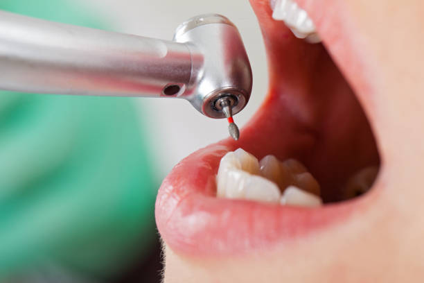 Best Walk-In Emergency Dental Services in Venus, TX